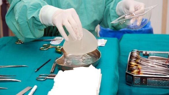 Brustvergréisserung Implantat