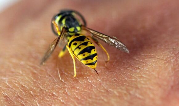 Wasp Sting fir Erliefnes Erweiderung